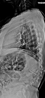 SK Spine | Digital Radiography, Air Abrasion and Dental Fillings