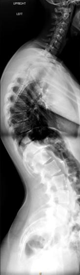 SK Spine | Sleep Apnea, TMJ Disorders and Invisalign&reg;