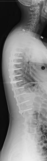 SK Spine | Ceramic Crowns, Digital Radiography and Orthodontics